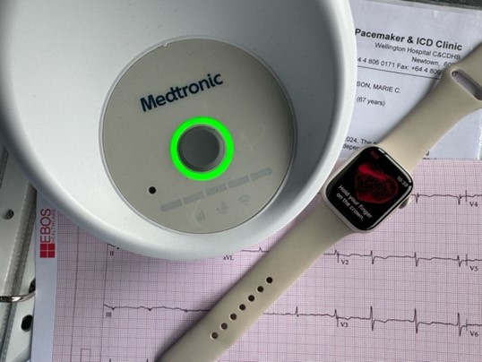 I will have 24/7 cardiac monitoring & 
surveillance for the rest of my life via 
my Medtronic home monitor. I keep an eye
on my cardiac rhythms with my Apple watch.
